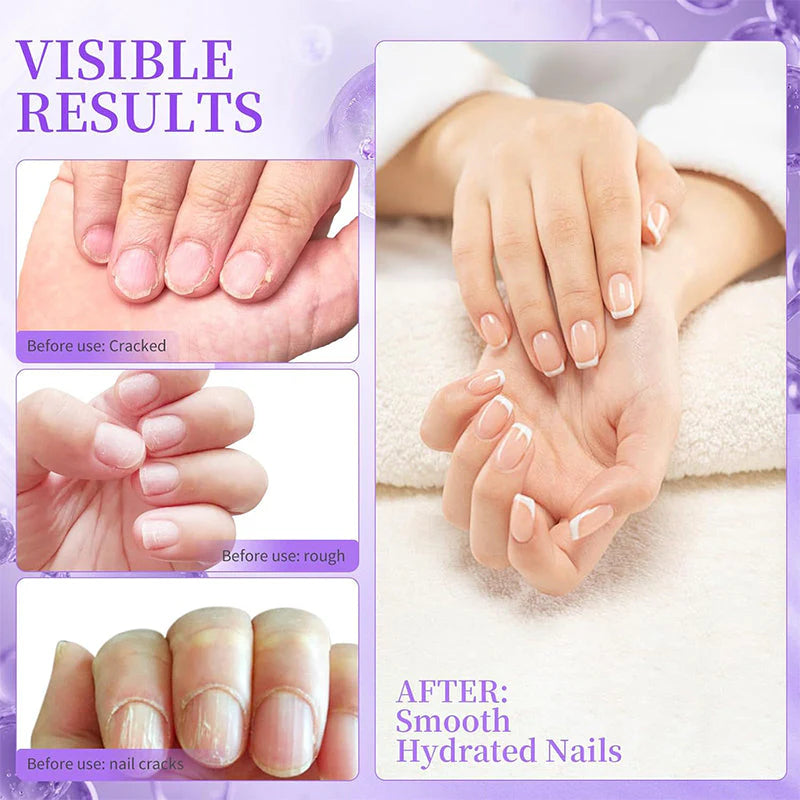 NailSoothe – Voedende nagelriemduwer met oliepen